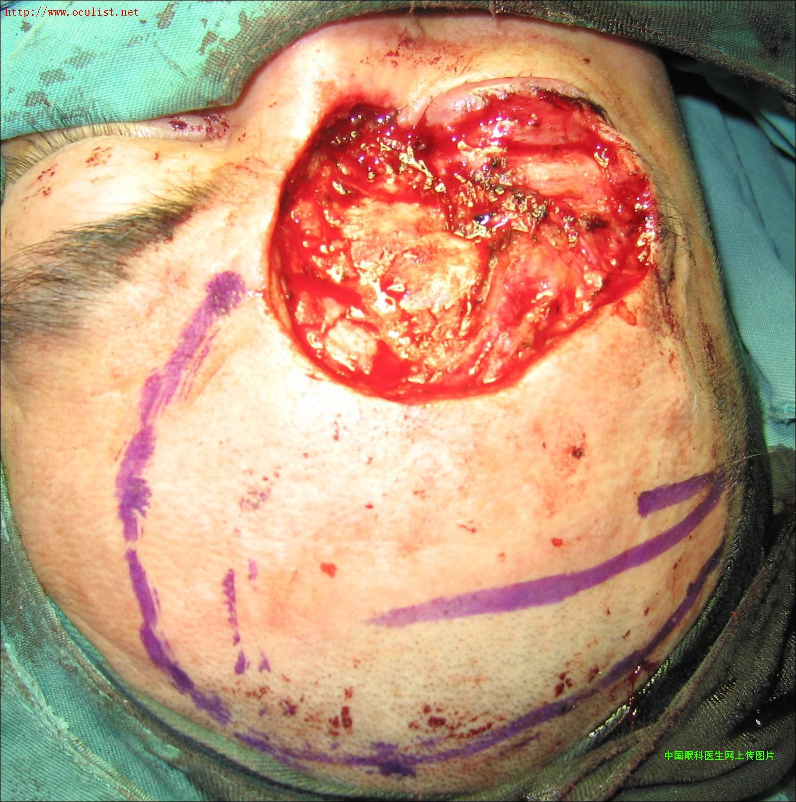 �������´������ͼƬ