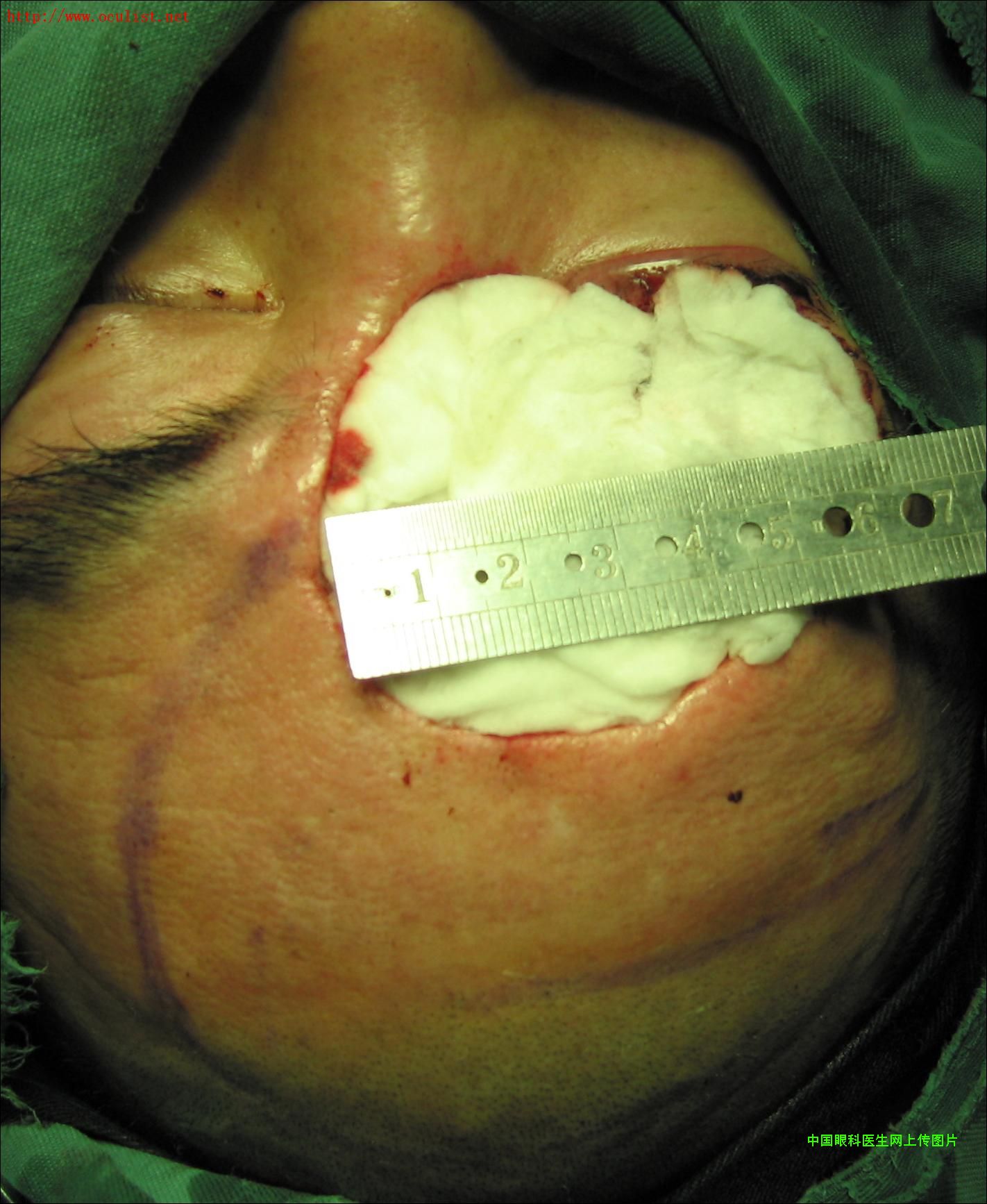 ͼƬ��������´��ڴ򿪲鿴