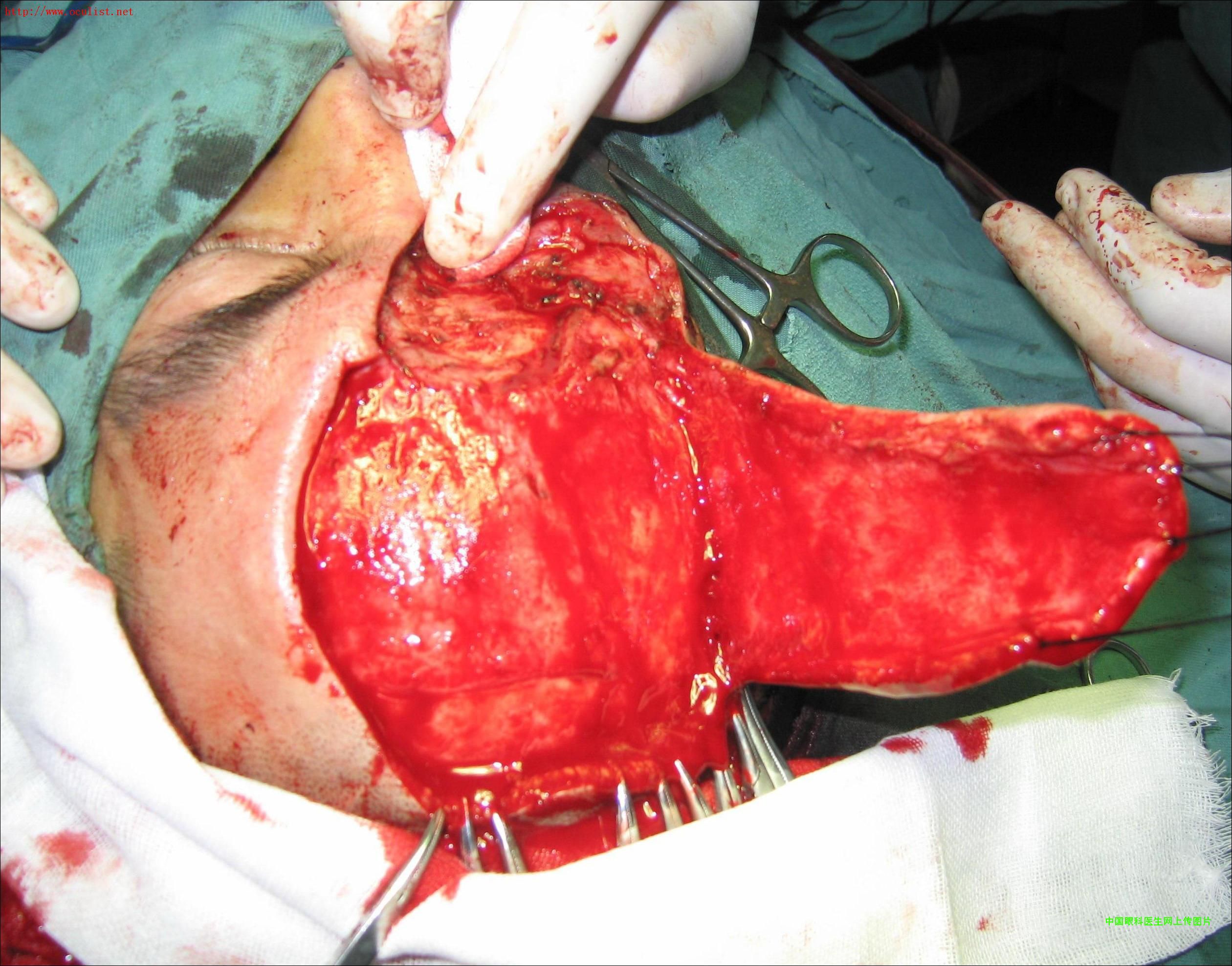 ͼƬ��������´��ڴ򿪲鿴