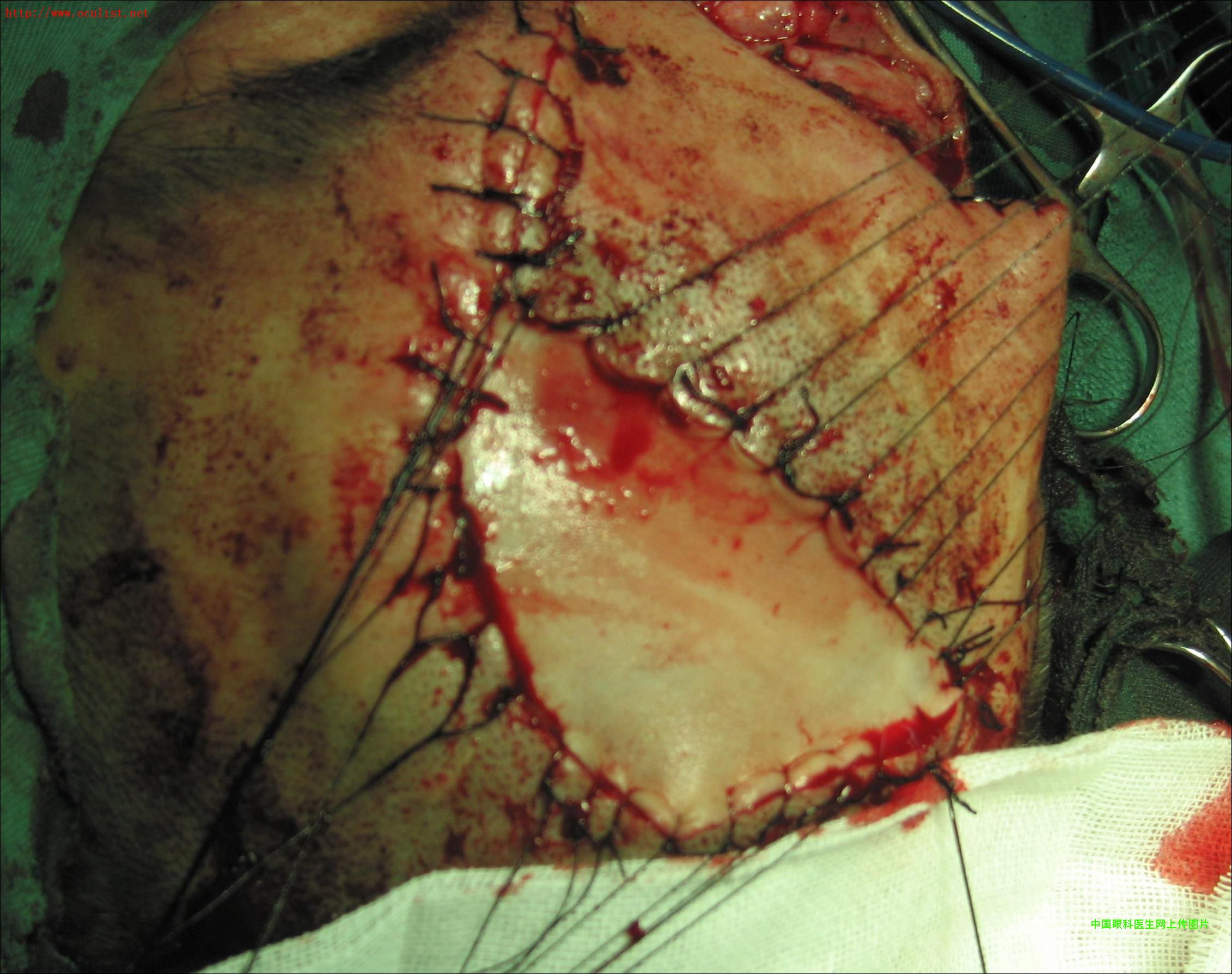 ͼƬ��������´��ڴ򿪲鿴