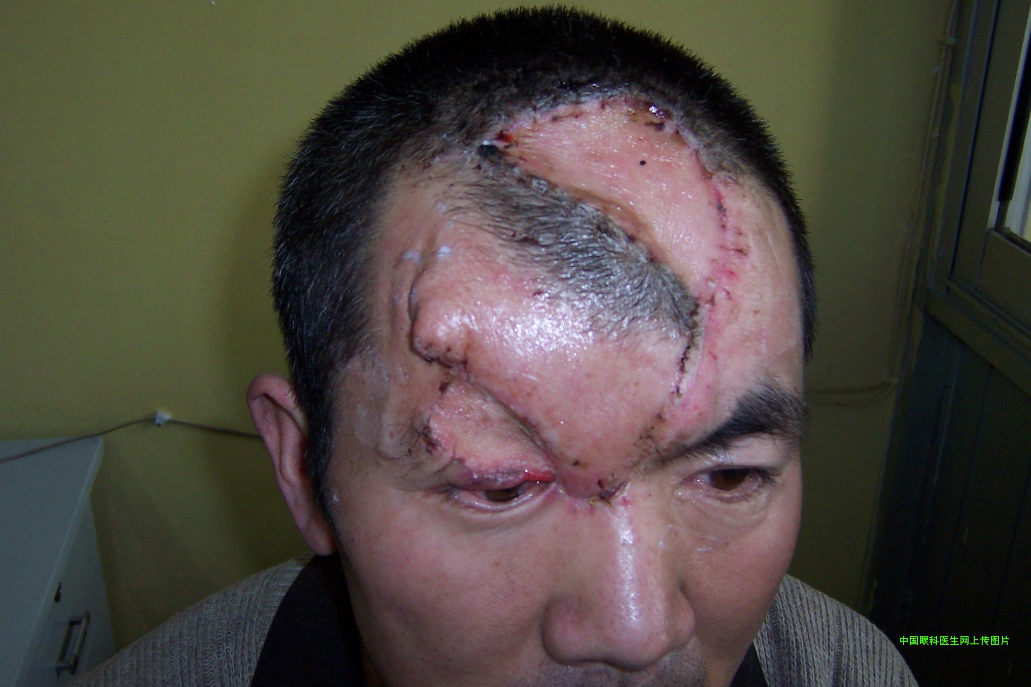 ͼƬ��������´��ڴ򿪲鿴