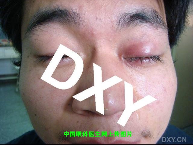 Click to view full yqj..jpg (925 X 697)