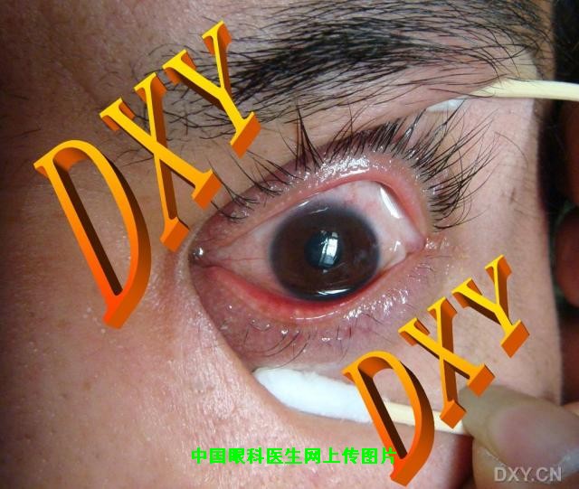 Click to view full yqj.2.jpg (1025 X 868)